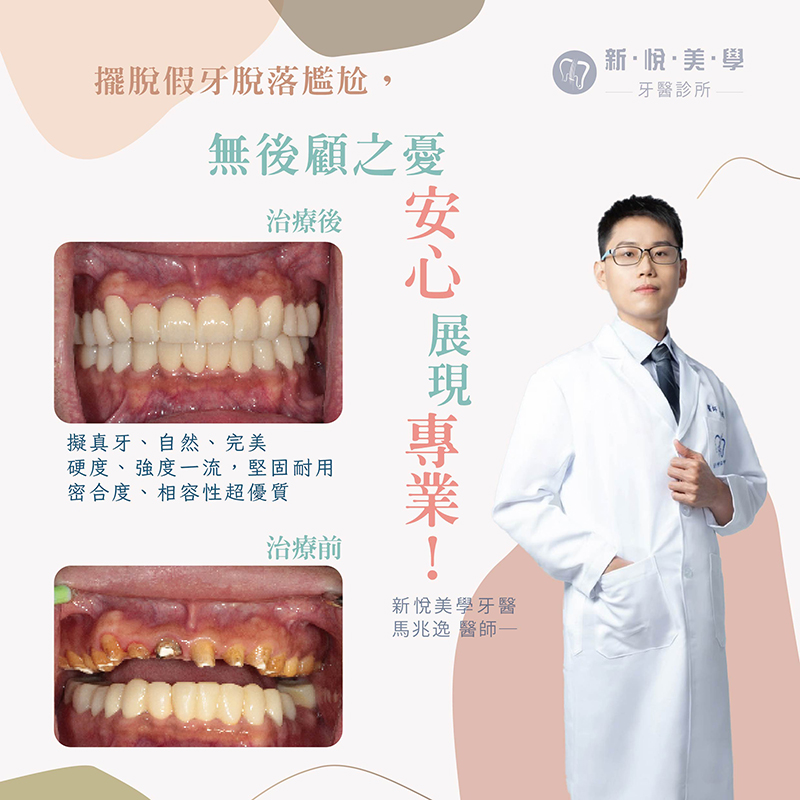 新悅美學牙醫診所的案例分享圖片